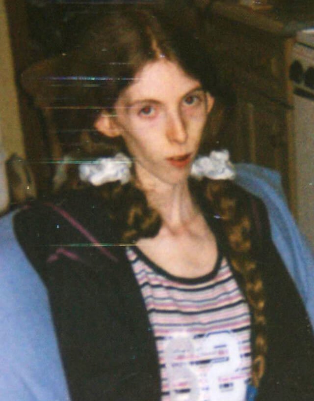 Photo of Esperanza Vite while suffering from celiac disease and other health challenges